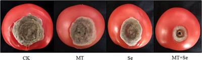 Synergistic Effect of Melatonin and Selenium Improves Resistance to Postharvest Gray Mold Disease of Tomato Fruit